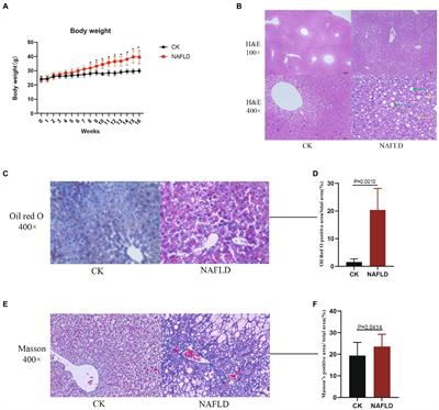 Characteristics of intestinal microbiota in C57BL/6 mice with non-alcoholic fatty liver induced by high-fat diet